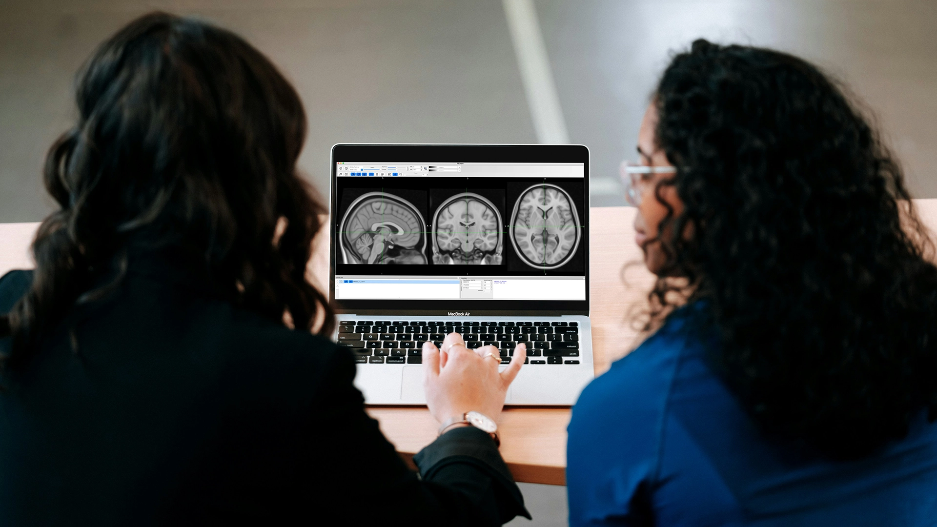 El Nuevo Sistema de IA del MIT Hace la Segmentación de Imágenes Más Rápida y Fácil